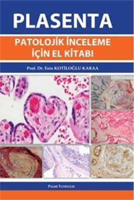 Palme Plasenta Patolojik İnceleme İçin El Kitabı Palme Yayınevi